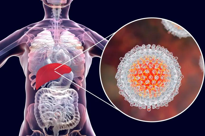 Hepatitis B & C Virus Test