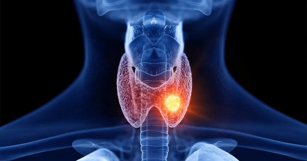 Thyroid Test Panel