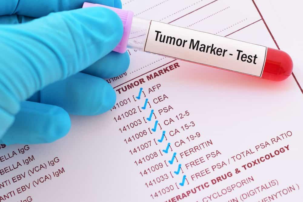 Tumor Marker